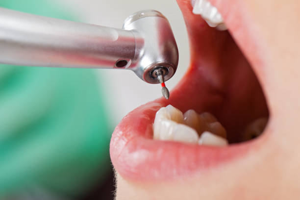  Rockwell Place, TX Emergency Dentist Pros